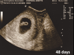 سونوگرافی بارداری در کرج