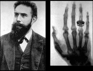 ویلهلم گونتن کاشف پرتو ایکس (سمت چپ) و اولین تصویر گرفته شده با این فناوری (سمت راست)