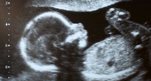 اهمیت سونوگرافی 3 ماه دوم بارداری