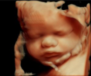 سونوگرافی 4 بعدی جنین چیست؟