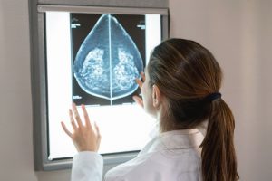 ماموگرافی برای بانوان زیر 40 سال ضرورتی ندارد.