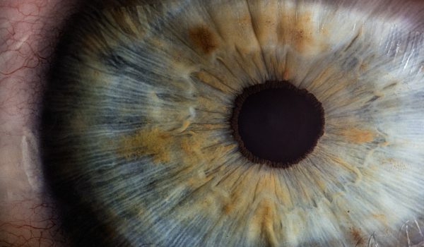 آنژیوگرافی چشم